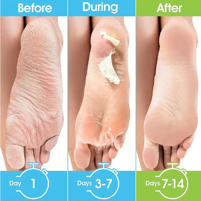 1 Pag = 1 Pair Honey Foot Mask – обзор и цена Foot Mask Peeling