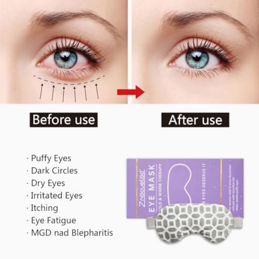2 in 1 Heated/Ice Eye Mask Moi – обзор и цена Eye Mask Heated