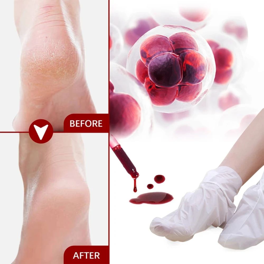1 Pair Fruit Acid Exfoliating  – обзор и цена Foot Mask Peeling