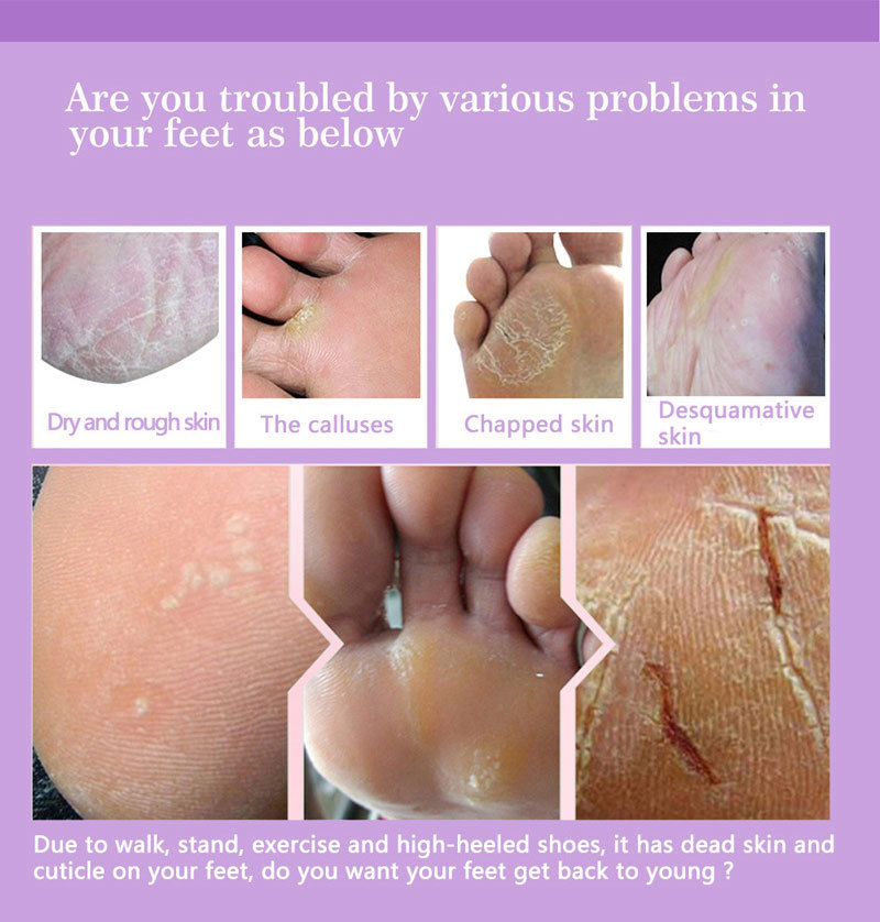 Feet Exfoliating Foot Masks Pe – обзор и цена Foot Mask Peeling