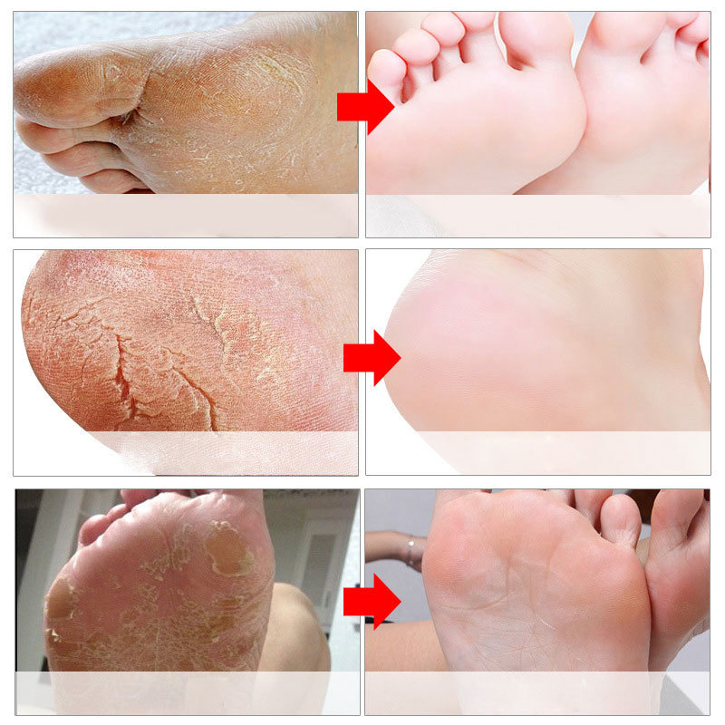 Feet Exfoliating Foot Masks Pe – обзор и цена Foot Mask Peeling